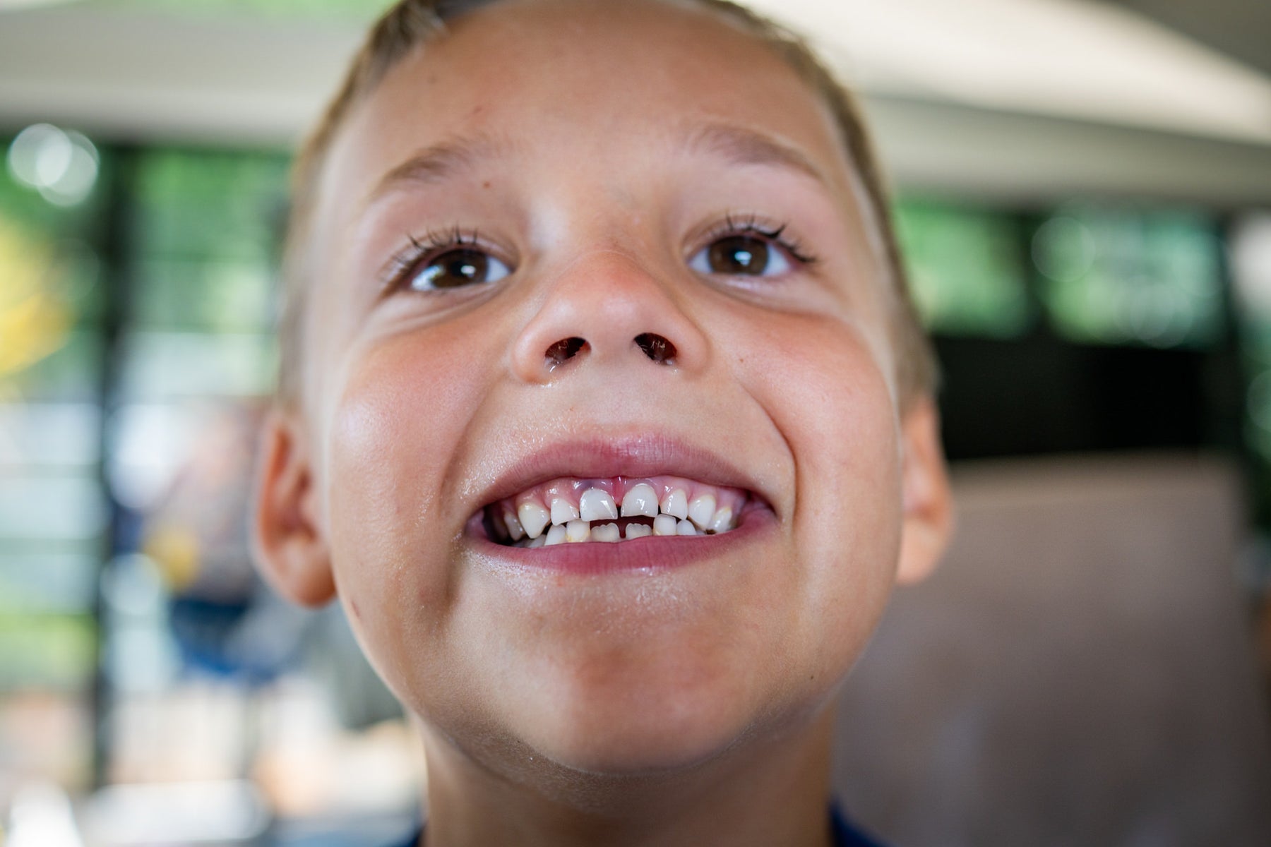 https://alphauniverseglobal.media.zestyio.com/closeup-kid-smile-portrait-teeth-happy-moment.jpg?height=1200&fit=bounds